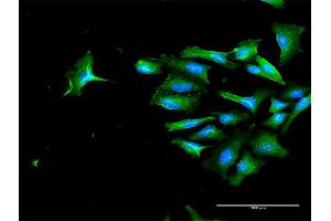 Immunofluorescence of purified MaxPab antibody to CD44 on HeLa cell. (CD44 antibody  (AA 1-361))