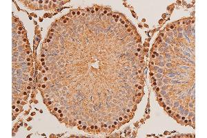 Immunohistochemistry (IHC) image for anti-Checkpoint Kinase 1 (CHEK1) (pSer296) antibody (ABIN6256251)