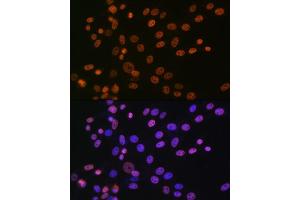 Immunofluorescence analysis of NIH-3T3 cells using hnRNP  Rabbit mAb (1564) at dilution of 1:100 (40x lens). (HNRNPA1 antibody)