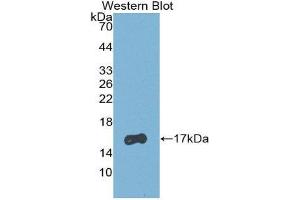 Western Blotting (WB) image for anti-Retinol Binding Protein 5, Cellular (RBP5) (AA 1-135) antibody (ABIN1860416) (Retinol Binding Protein 5 antibody  (AA 1-135))