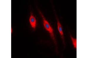 Immunofluorescent analysis of PDLIM1 staining in HeLa cells. (PDLIM1 antibody  (Center))