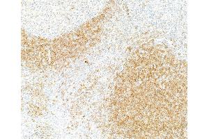 Immunohistochemistry (IHC) image for anti-B-cell antigen receptor complex-associated protein alpha chain (CD79A) (AA 176-226) antibody (ABIN7454005) (Recombinant CD79a antibody  (AA 176-226))