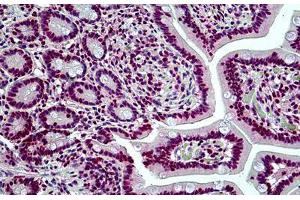 Human Small Intestine: Formalin-Fixed, Paraffin-Embedded (FFPE) (SMARCA4 antibody  (AA 2-14))