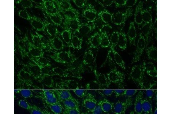 MTIF2 antibody