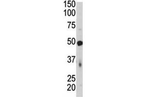 PDK4 antibody  (AA 382-410)