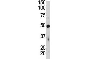 Western blot of PDK4 antibody and mouse skeletal muscle tissue lysate. (PDK4 antibody  (AA 382-410))
