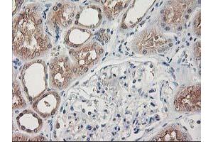 Immunohistochemical staining of paraffin-embedded Human Kidney tissue using anti-NIF3L1 mouse monoclonal antibody. (NIF3L1 antibody)