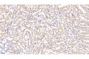Detection of TL1A in Rat Kidney Tissue using Polyclonal Antibody to TNF Like Ligand 1A (TL1A) (TNF Like Ligand 1A (AA 70-230) antibody)