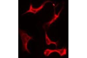 ABIN6276139 staining LOVO by IF/ICC. (OR2M2 antibody  (C-Term))