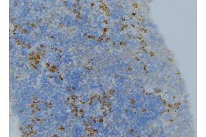 ABIN6276616 at 1/100 staining Human lymph node tissue by IHC-P.