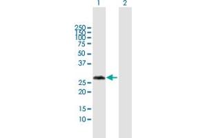 Western Blot analysis of VCX3A expression in transfected 293T cell line by VCX3A MaxPab polyclonal antibody.