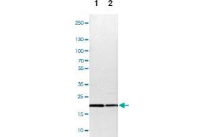 Western blot analysis of Lane 1: NIH-3T3 cell lysate (Mouse embryonic fibroblast cells), Lane 2: NBT-II cell lysate (Rat Wistar bladder tumour cells) with TOMM22 polyclonal antibody  at 1:100-1:500 dilution.