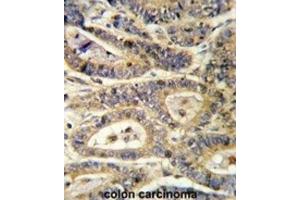 Immunohistochemistry (IHC) image for anti-Insulin-Like Growth Factor Binding Protein 6 (IGFBP6) antibody (ABIN3002791) (IGFBP6 antibody)