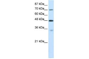 WB Suggested Anti-CARS Antibody Titration:  0. (CARS antibody  (C-Term))