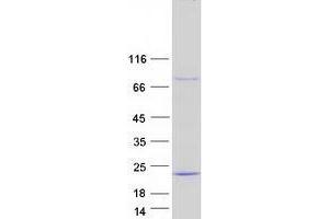 Validation with Western Blot (UBE2D3 Protein (Transcript Variant 2) (Myc-DYKDDDDK Tag))