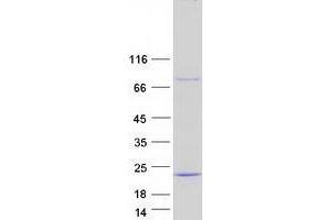 Validation with Western Blot