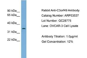 WB Suggested Anti-C3orf49  Antibody Titration: 0. (C3orf49 antibody  (Middle Region))