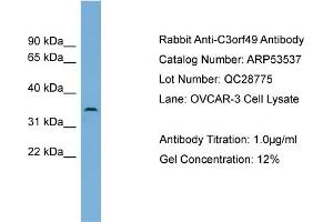 WB Suggested Anti-C3orf49  Antibody Titration: 0. (C3orf49 antibody  (Middle Region))