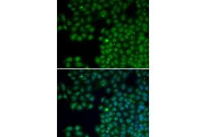 Immunofluorescence analysis of HeLa cells using NUDT6 antibody. (NUDT6 antibody)