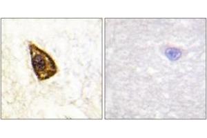 Immunohistochemistry analysis of paraffin-embedded human brain tissue, using Trk B (Ab-705) Antibody. (TRKB antibody  (AA 671-720))