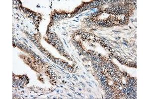 Immunohistochemical staining of paraffin-embedded liver tissue using anti-NIT2 mouse monoclonal antibody. (NIT2 antibody)