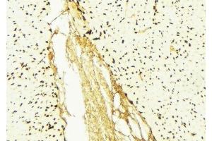 ABIN6276426 at 1/100 staining Mouse liver tissue by IHC-P.