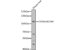 Western blot analysis of extracts of Mouse liver, using CD166/CD166/ALCAM antibody (ABIN6127405, ABIN6136759, ABIN6136760 and ABIN6219454) at 1:1000 dilution. (CD166 antibody  (AA 28-180))