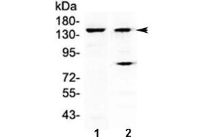Western blot testing of 1) mouse liver and 2) human A431 lysate with FBXL11 antibody at 0.