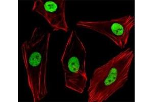 Fluorescent image of SH-SY5Y cells stained with SUMO2/3 antibody diluted at 1:100 dilution. (SUMO2/3 antibody  (AA 49-81))