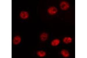 ABIN6275192 staining LOVO by IF/ICC. (HOXA6 antibody  (Internal Region))