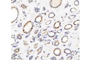 Immunohistochemistry analysis of paraffin-embedded human kidney using,DLAT (ABIN7073661) at dilution of 1: 1000