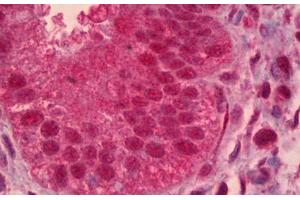 Anti-PAX9 antibody IHC staining of human uterus, endometrium. (PAX9 antibody)