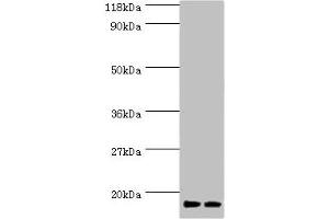 Western blot All lanes: RPS19 antibody at 2 μg/mL Lane 1: EC109 whole cell lysate Lane 2: 293T whole cell lysate Secondary Goat polyclonal to rabbit IgG at 1/15000 dilution Predicted band size: 17 kDa Observed band size: 17 kDa