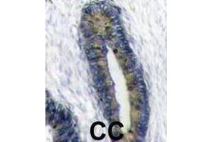 Immunohistochemistry (IHC) image for anti-Finkel-Biskis-Reilly Murine Sarcoma Virus (FBR-MuSV) Ubiquitously Expressed (FAU) antibody (ABIN2998456) (FAU antibody)