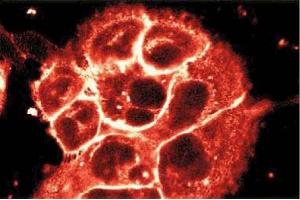 Immunofluorescent staining of A431 cells. (P-Cadherin antibody  (AA 72-259))