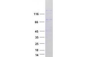 Validation with Western Blot (DUOX1 Protein (Transcript Variant 2) (Myc-DYKDDDDK Tag))