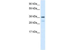 WB Suggested Anti-TCFL1 Antibody Titration:  0. (VPS72 antibody  (Middle Region))