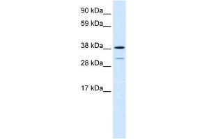 WB Suggested Anti-TCFL1 Antibody Titration:  0.