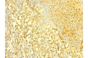 Immunohistochemistry of paraffin-embedded human tonsil tissue using ABIN7169906 at dilution of 1:100 (SLC4A7 antibody  (AA 240-400))