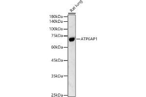 Western blot analysis of extracts of Rat lung, using  antibody (ABIN3021729, ABIN3021730, ABIN3021731 and ABIN6215663) at 1:500 dilution.