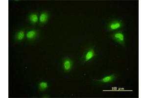 Immunofluorescence of monoclonal antibody to CRY1 on HeLa cell. (CRY1 antibody  (AA 1-586))