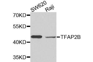 Western blot analysis of extracts of various cell lines, using TFAP2B antibody. (TFAP2B antibody)