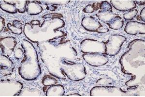 Immunohistochemistry (IHC) image for anti-Keratin 14 (KRT14) (C-Term) antibody (ABIN870554)