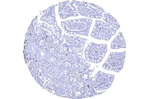 CD22 positive B lymphocytes are rare in this sample of ileum mucosa (Recombinant CD22 antibody  (AA 52-178))