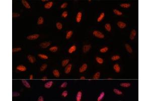 Immunofluorescence analysis of U-2 OS cells using ARID1B Polyclonal Antibody at dilution of 1:100. (ARID1B antibody)