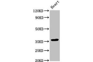 Western Blot Positive WB detected in: Rat heart tissue All lanes: NMI antibody at 3. (NMI antibody  (AA 62-202))