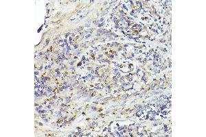 Immunohistochemistry of paraffin-embedded human tonsil using IL6R Rabbit pAb (ABIN3015521, ABIN3015522, ABIN3015523, ABIN1680455 and ABIN6218635) at dilution of 1:50 (40x lens). (IL-6 Receptor antibody  (AA 20-320))