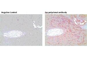 Immunohistochemistry analysis of formalin-fixed, paraffin-embedded human spleen tissue stained with Fas polyclonal antibody,  at 10 μg/mL. (FAS antibody)