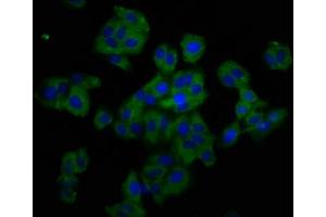 Immunofluorescence staining of HepG2 cells with ABIN7173864 at 1:200, counter-stained with DAPI. (TNFRSF19 antibody  (AA 276-415))