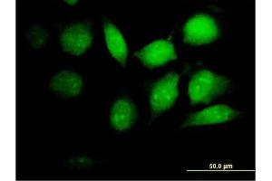 Immunofluorescence of purified MaxPab antibody to PSMB8 on HeLa cell. (PSMB8 antibody  (AA 1-272))